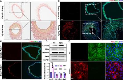 Platelet-Derived Microvesicles Promote VSMC Dedifferentiation After Intimal Injury via Src/Lamtor1/mTORC1 Signaling